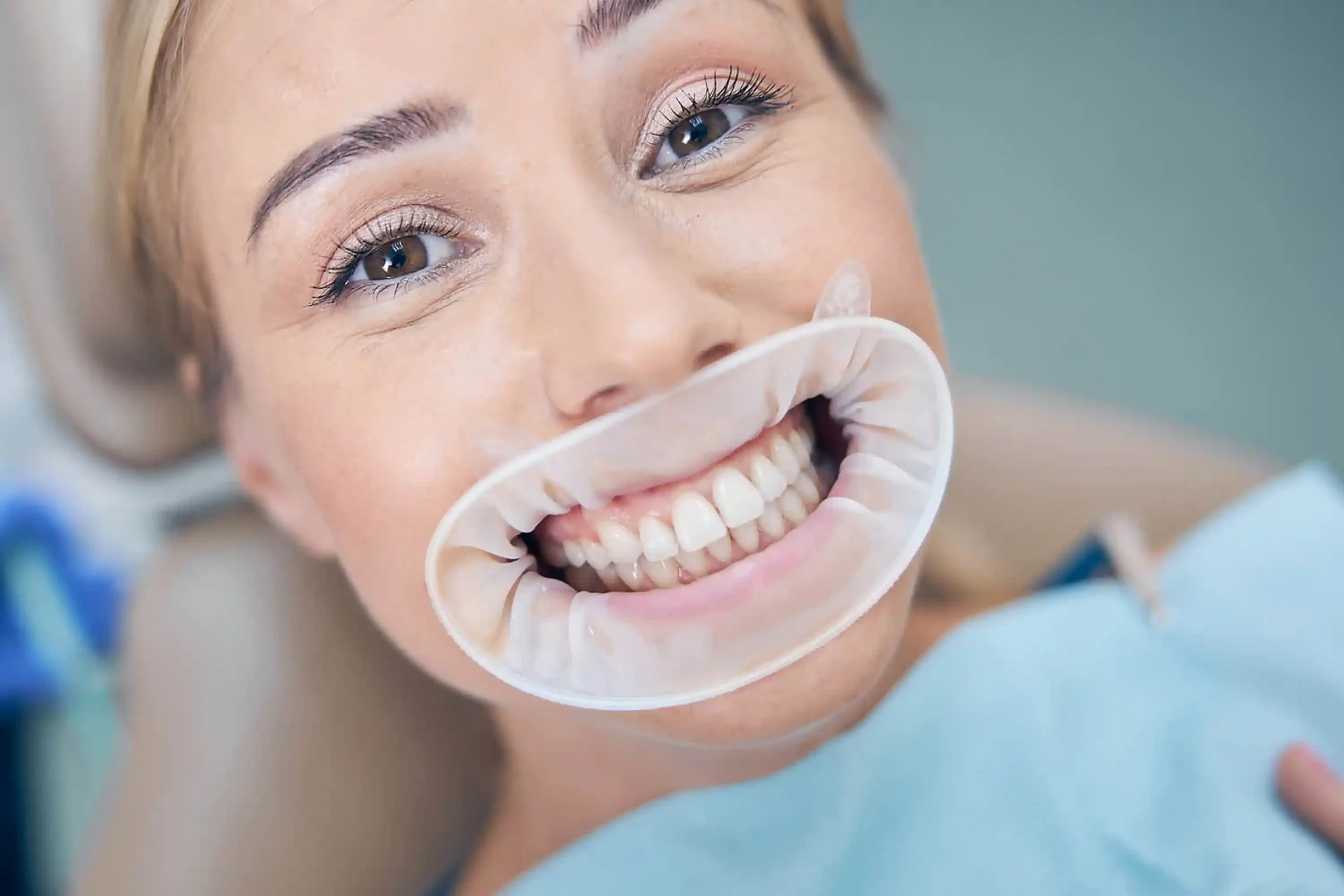 2026-04-nev-plomby-Denticon-web-2