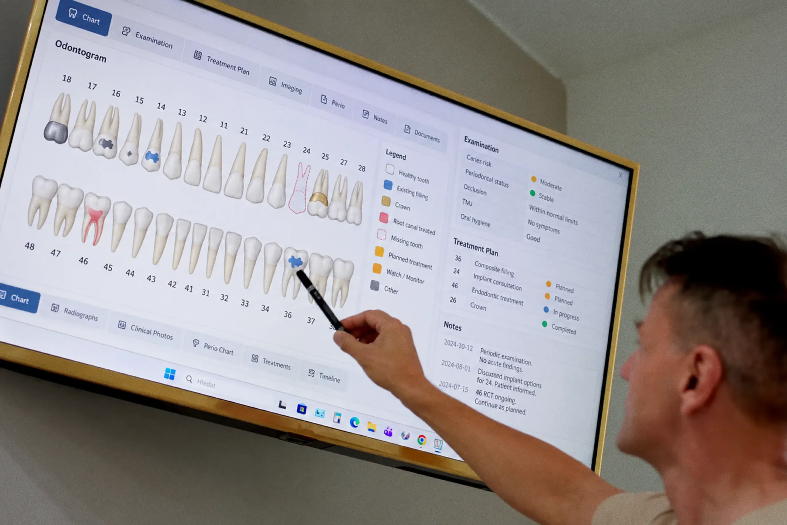 Denticon-Vstupná zubná prehliadka-05
