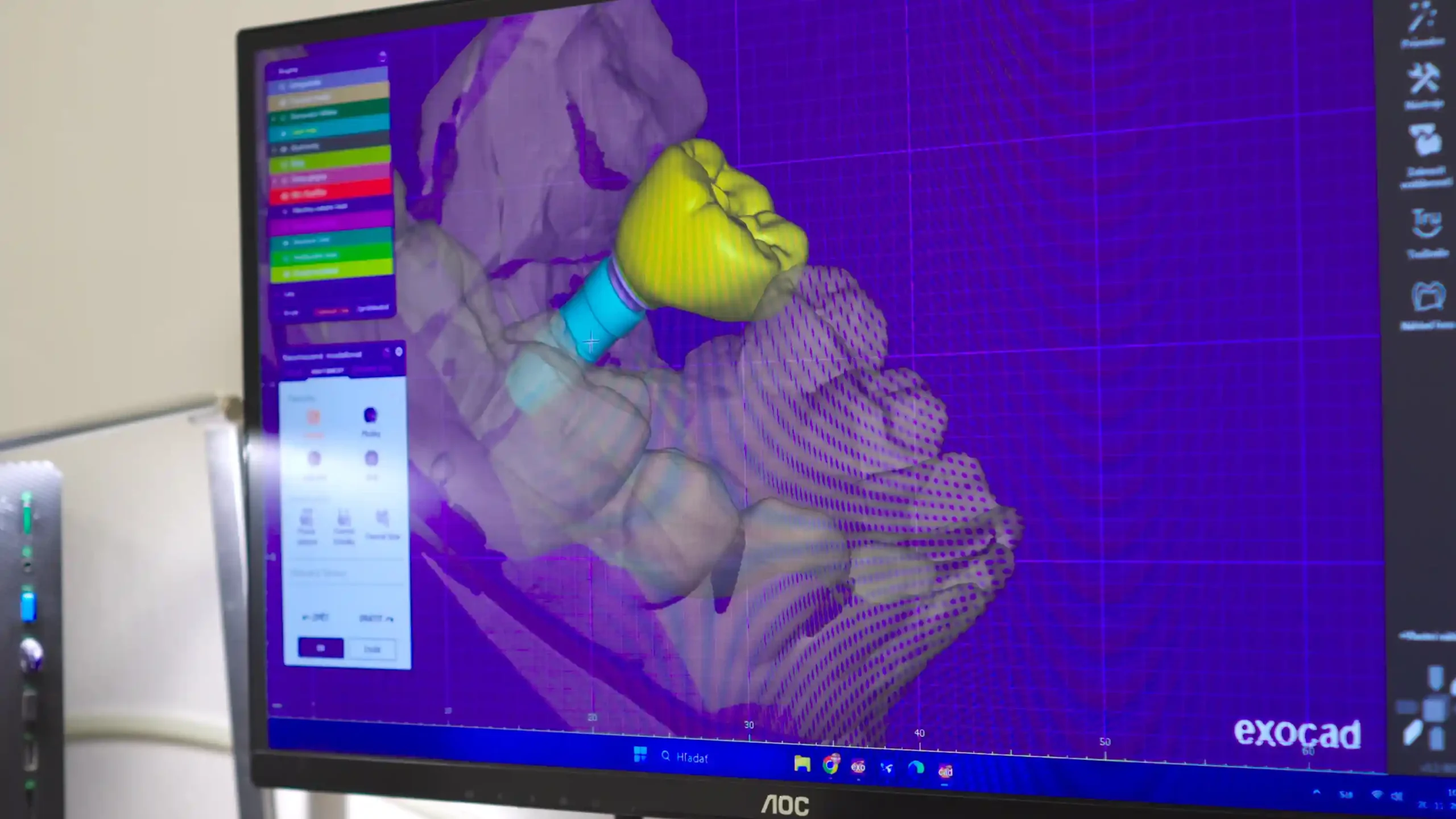 11-2025- Implantát - FAQ - HD - 4 small