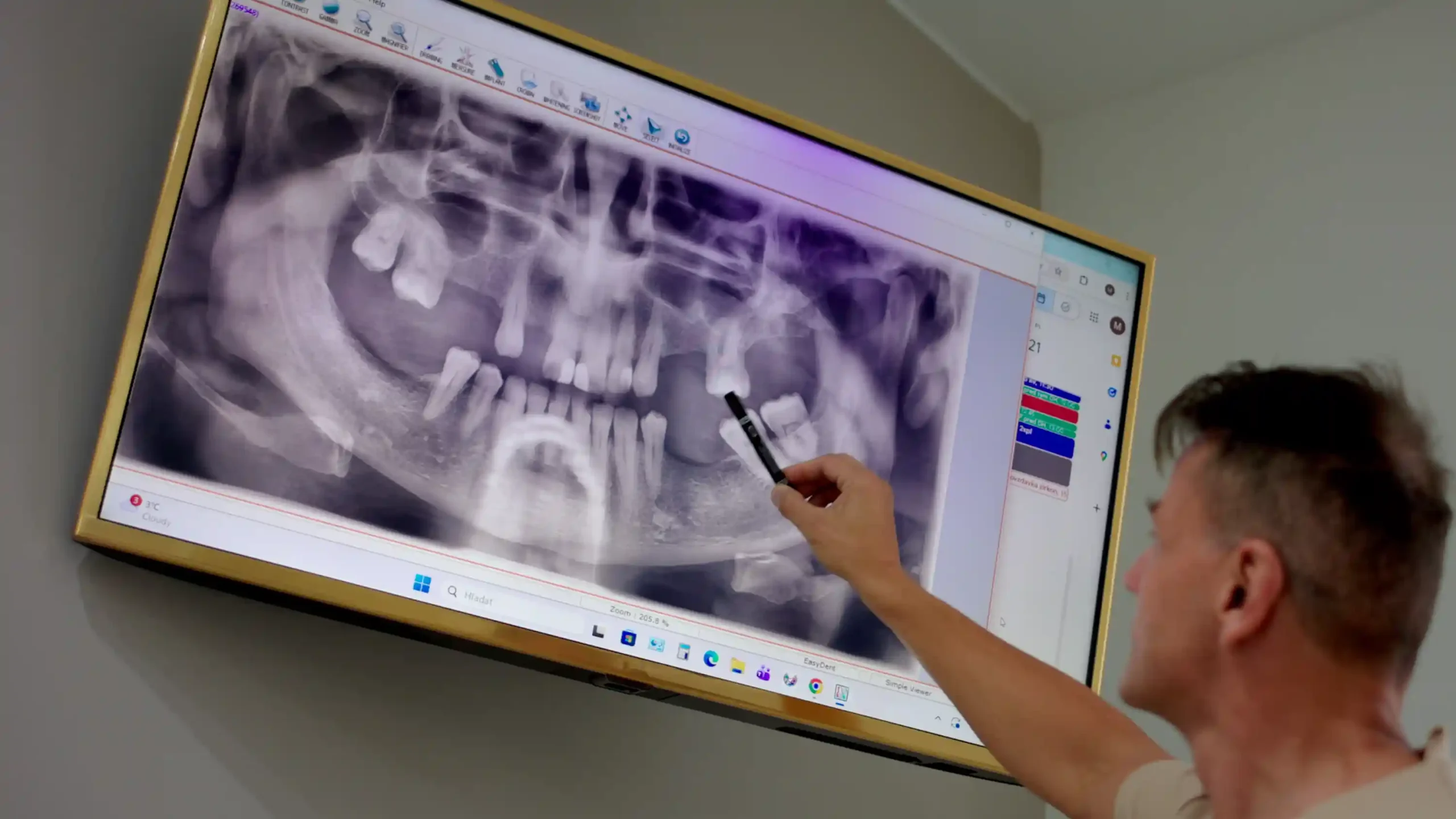 11-2025- Implantát - Zuby a zdravie 3 small