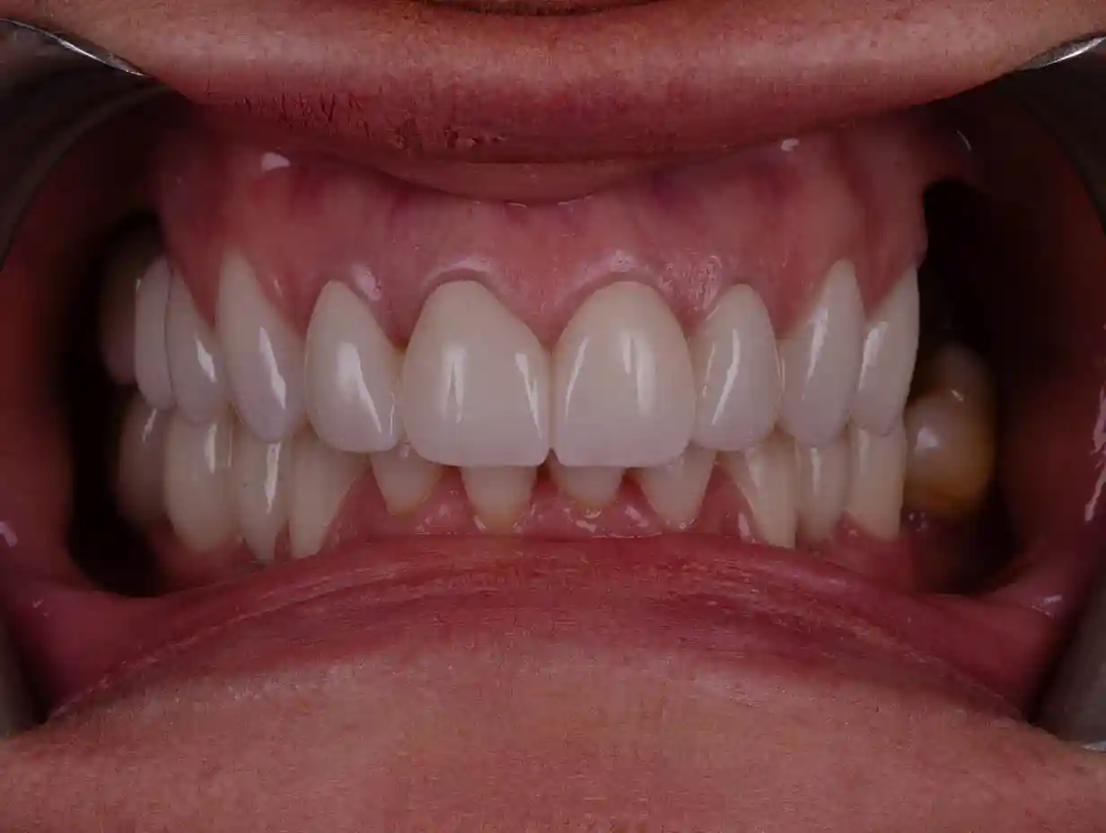 1325_DENTICON_Web_pred a po-2026-04 - 1po