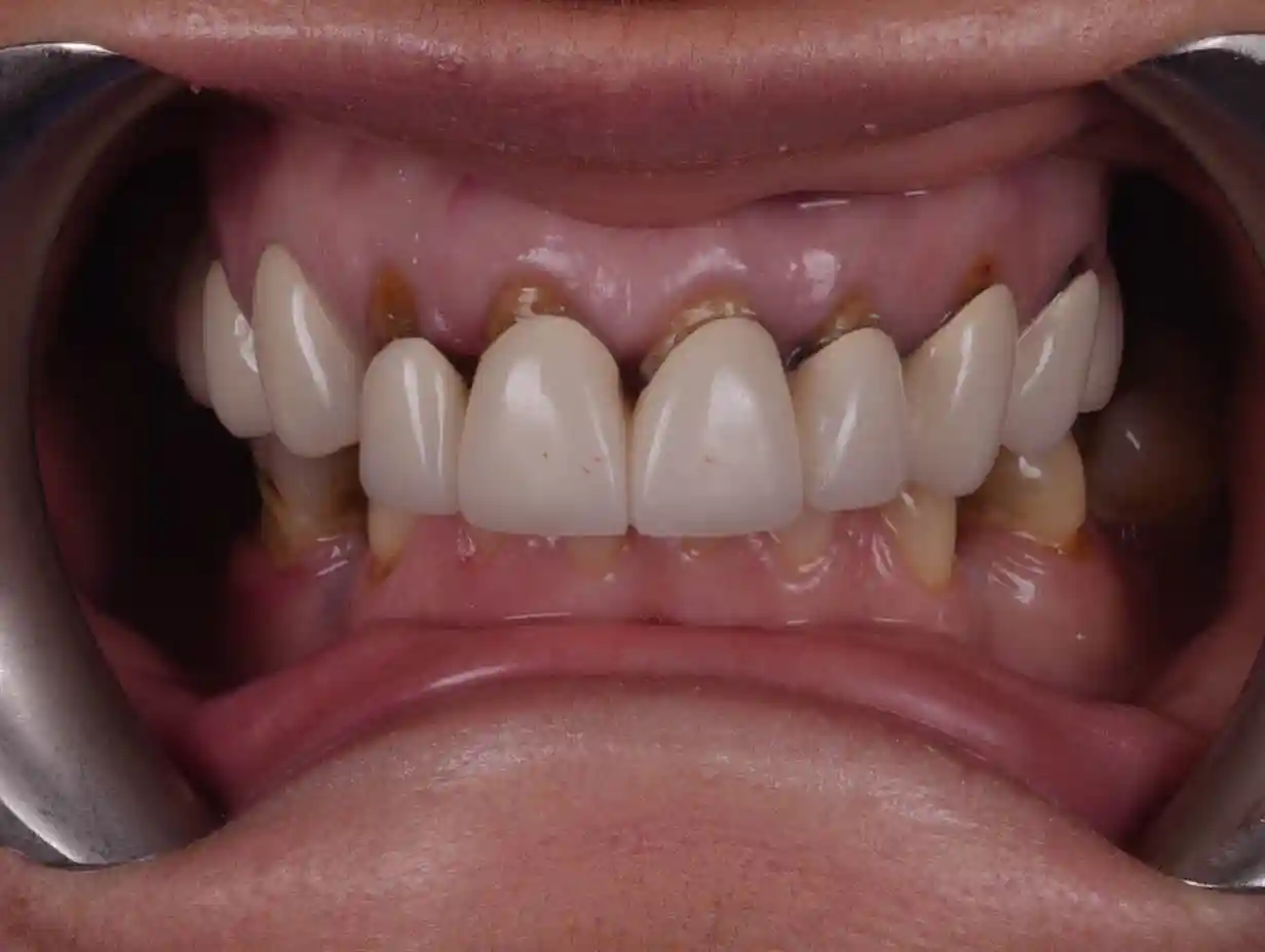 1325_DENTICON_Web_pred a po-2026-04 - 1pred