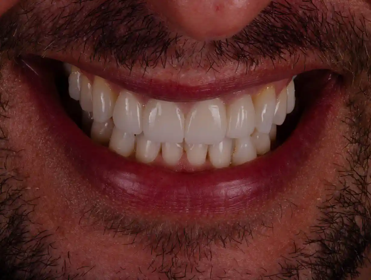 1325_DENTICON_Web_pred a po-2026-04 - 2po