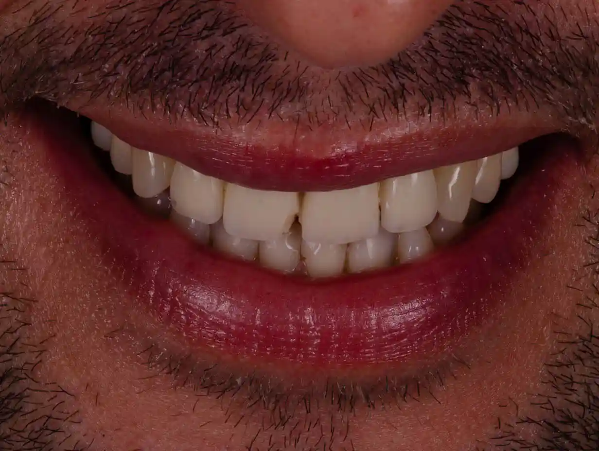 1325_DENTICON_Web_pred a po-2026-04 - 2pred